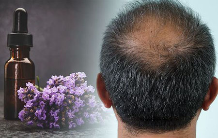 1623337116 509 فواید روغن اسطوخودوس برای مو مضرات و نحوه استفاده فواید روغن اسطوخودوس برای مو + مضرات و نحوه استفاده