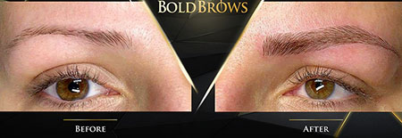 bold brows 02 بولدبروز ابرو چیست و چه مزیتهایی دارد